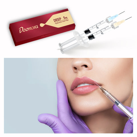 Hyaluronic Acid Filler Professional Use for Lip Nasolabial folds and Cheeks