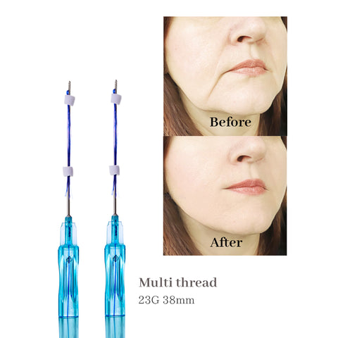 PDO Thread Mono Multi Cog Molding Fish Bone Thread Face and Body Lifting